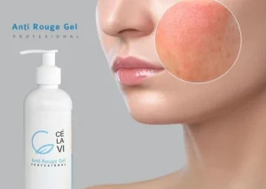 ژل آنتی رژ ضد قرمزی پوست سلاوی
